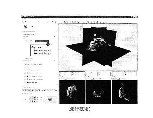 6396310-第一レンダリング投影と第二レンダリング投影との間のトランジションをユーザーに表示するための方法および装置 図000011