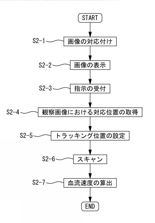 6402921-光コヒーレンストモグラフィ装置、および速度測定用プログラム 図000011