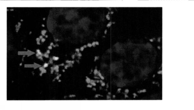 6441472-活性成分として外因性ミトコンドリアを含む組成物、ならびにその使用およびそのための細胞修復法 図000011