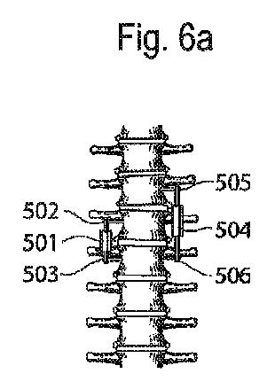 6636420-骨整形用の装置および方法 図000011