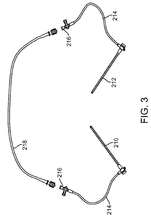 6768697-頚動脈血流の逆流を確立する方法およびシステム 図000011