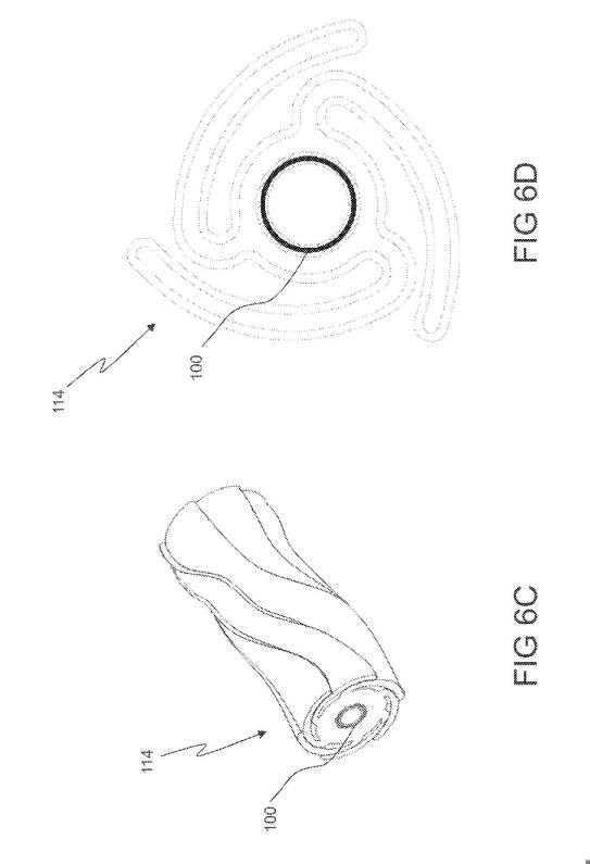 6793147-動脈瘤を治療するためのデバイスおよび方法 図000011