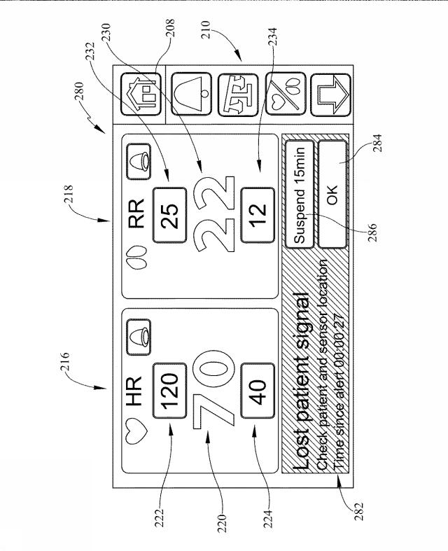 6805121-バイタルサインのモニター機能およびアラート機能を有する患者支持装置 図000011