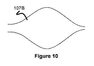 6854282-押圧可能なインプラント送出システム 図000011