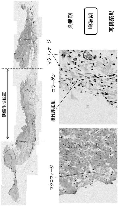 6871947-亜鉛イオン徐放性に優れる塩化水酸化亜鉛およびその製造方法 図000011