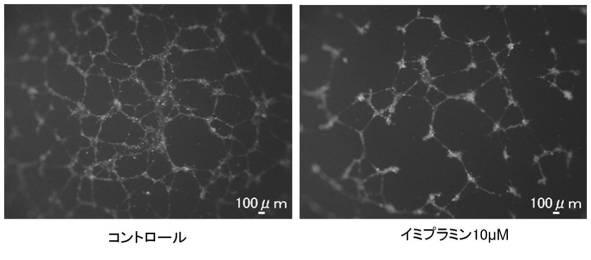 6952980-血管新生阻害薬 図000011