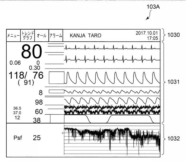 6966772-循環系指標算出プログラム、循環系指標算出装置、循環系指標算出システム及び循環系指標算出方法 図000011