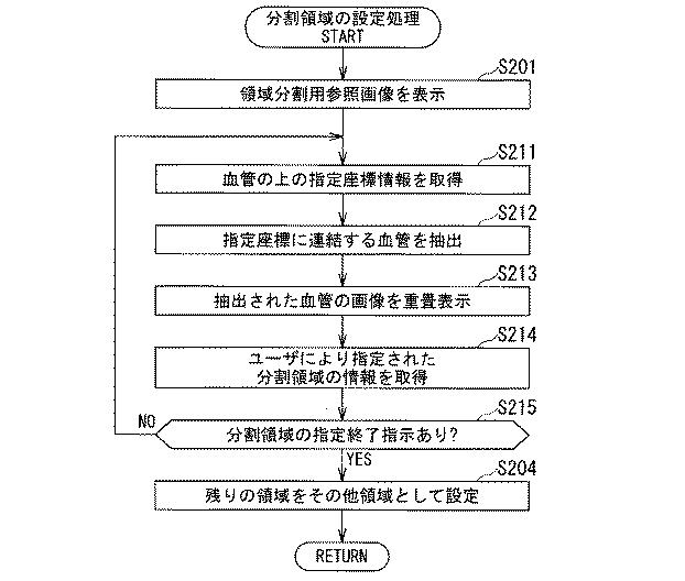 5835912-医用画像診断装置および医用画像処理装置 図000012