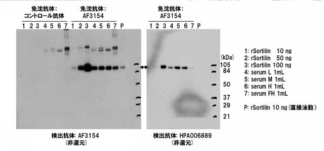 5852433-ソルチリンによる動脈硬化の判定方法 図000012