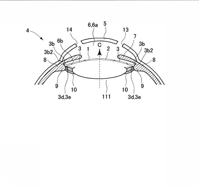 6023378-眼内レンズ及び眼内レンズのハプティック 図000012