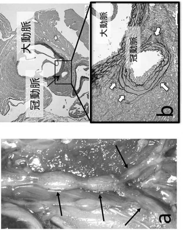 6023496-炎症性動脈瘤の診断方法 図000012