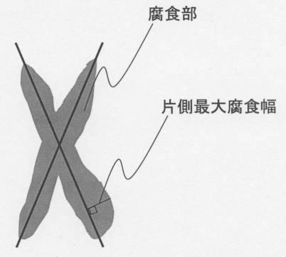 6051784-容器用樹脂被覆金属板 図000012