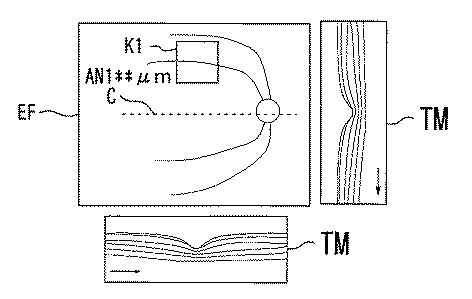 6241040-眼科解析装置、及び眼科解析プログラム 図000012