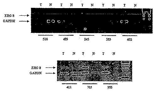 6383743-ＥＲＧ遺伝子発現における前立腺癌特異的変化ならびにそれらの変化に基づく検出および治療方法 図000012