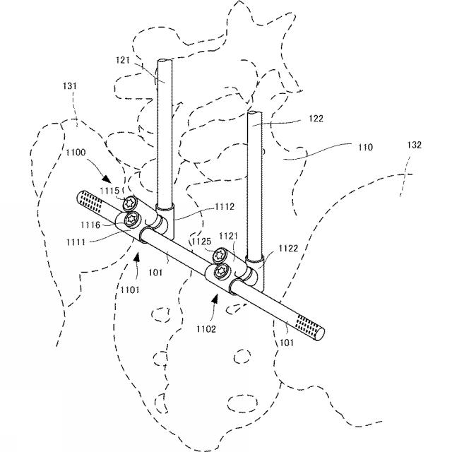 6433017-椎骨固定ロッド連結用インプラント 図000012