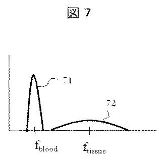 6444519-超音波診断装置、及び超音波撮像方法 図000012