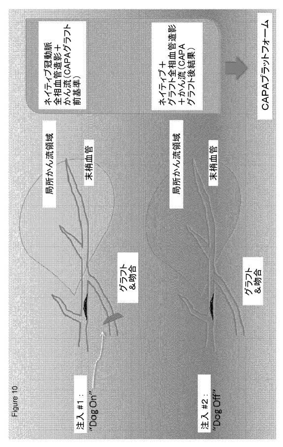 6561180-血管造影及びかん流の定量化並びに解析手法 図000012