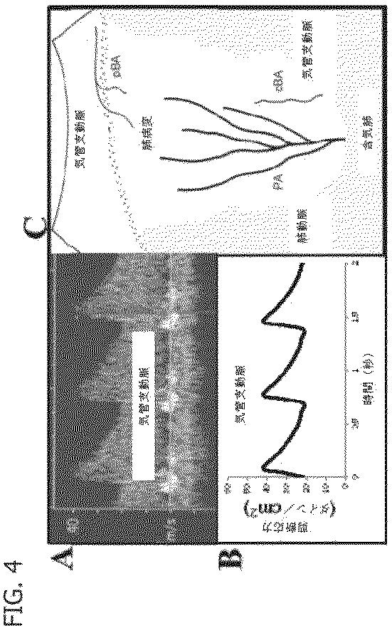 6684706-腫瘍微細環境のための試験管内モデル 図000012