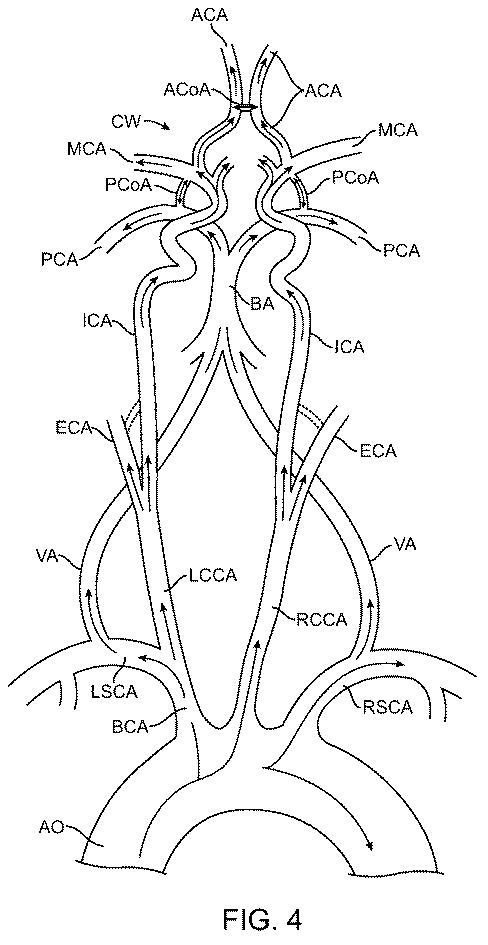 6768697-頚動脈血流の逆流を確立する方法およびシステム 図000012