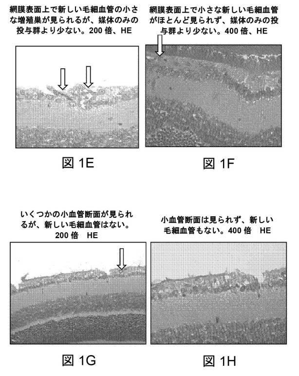 6867288-リファマイシンの眼科用組成物およびその使用 図000012