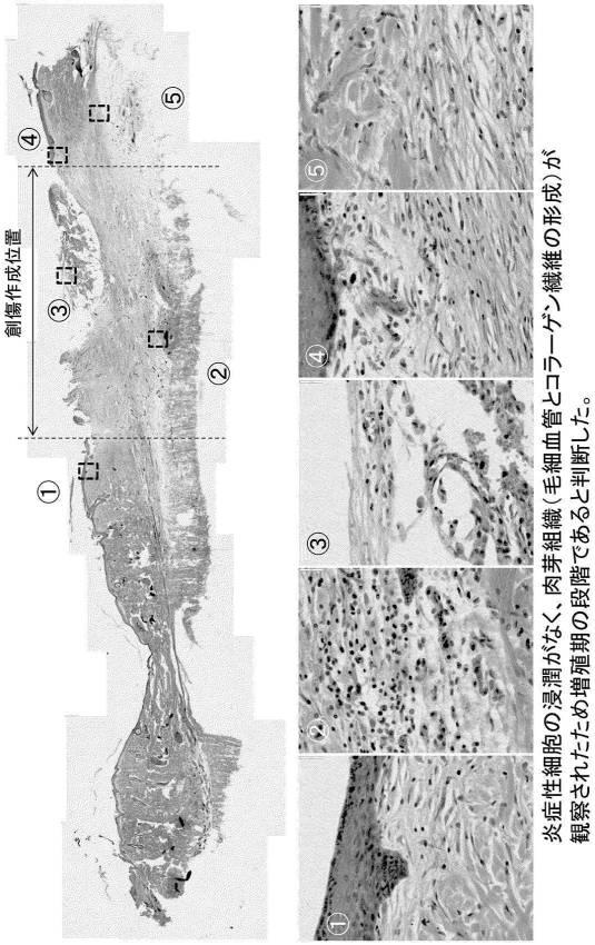 6871947-亜鉛イオン徐放性に優れる塩化水酸化亜鉛およびその製造方法 図000012