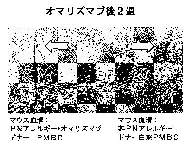 6878301-アレルゲンに対する反応を予防するための遺伝子治療 図000012