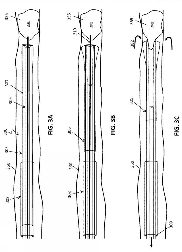 6924256-予め組み込まれた反転トラクタの血栓除去装置および方法 図000012