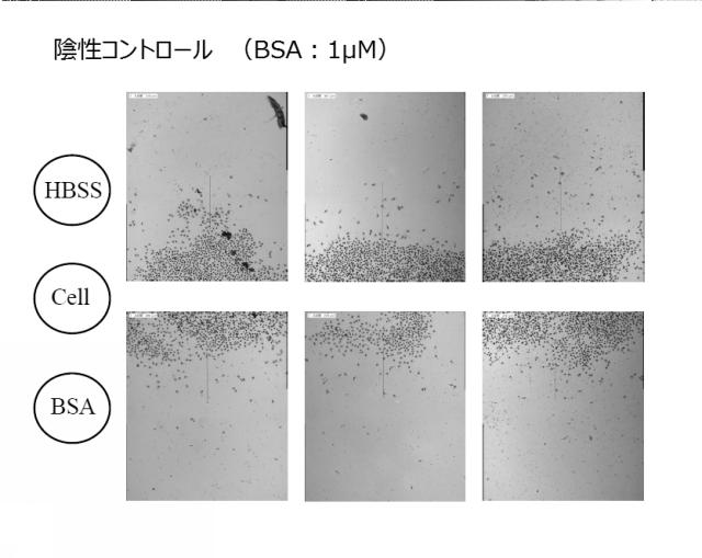 5807937-好中球活性化に起因する疾患の治療薬、治療方法及び検査方法 図000013