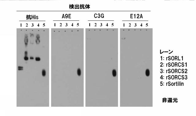 5852433-ソルチリンによる動脈硬化の判定方法 図000013