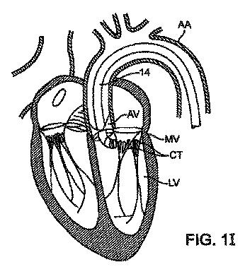 5872692-人工治療装置 図000013