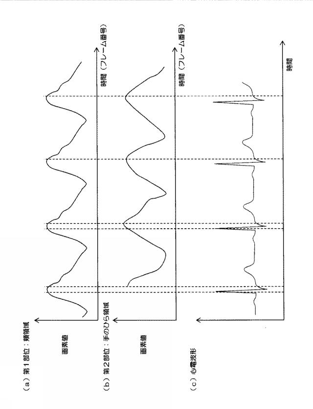 6072893-脈波伝播速度の測定方法、その測定方法を用いた測定システムの作動方法及び脈波伝播速度の測定システム並びに撮像装置 図000013