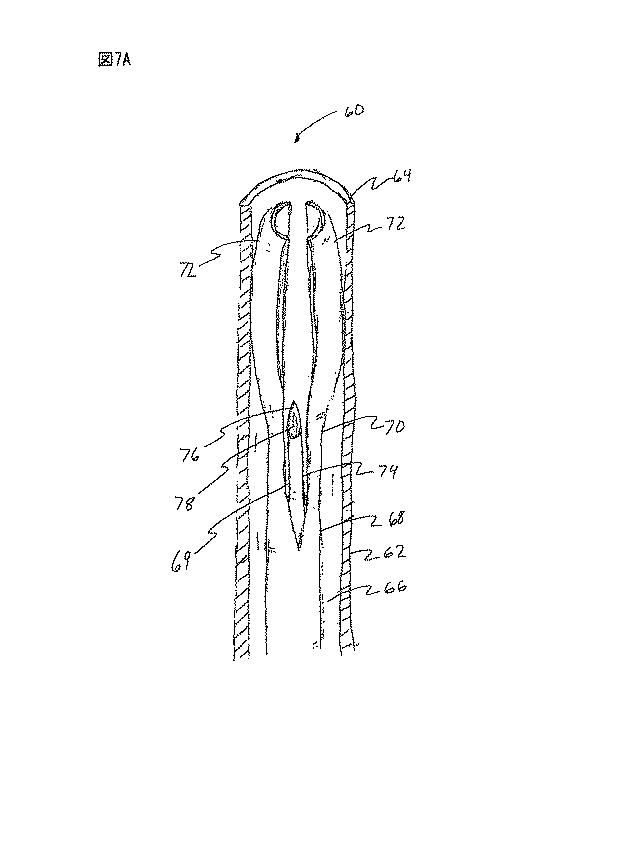 6235672-粘膜下医療処置を実行するための方法及びシステム 図000013