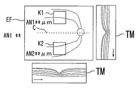 6241040-眼科解析装置、及び眼科解析プログラム 図000013