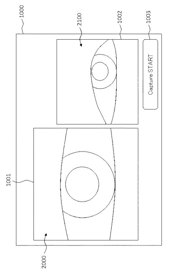 6321430-眼科装置 図000013