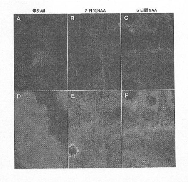 6356021-胚体内胚葉 図000013