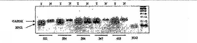 6383743-ＥＲＧ遺伝子発現における前立腺癌特異的変化ならびにそれらの変化に基づく検出および治療方法 図000013