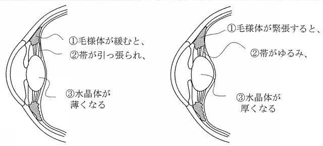 6573268-複合波治療器 図000013