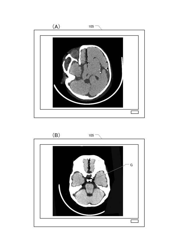 6731870-医用断面表示装置及び断面画像表示方法 図000013