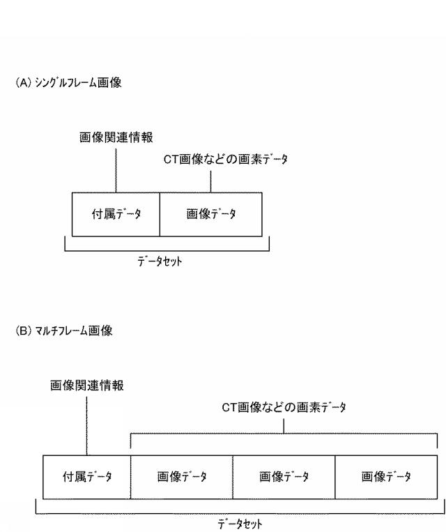 6859572-医用画像表示装置、医用画像表示方法、および医用画像表示プログラム 図000013