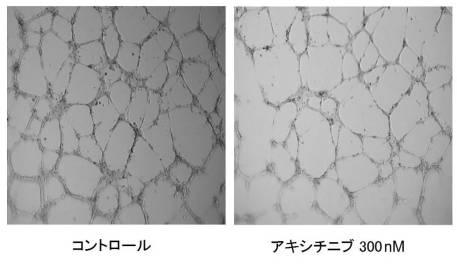 6952980-血管新生阻害薬 図000013