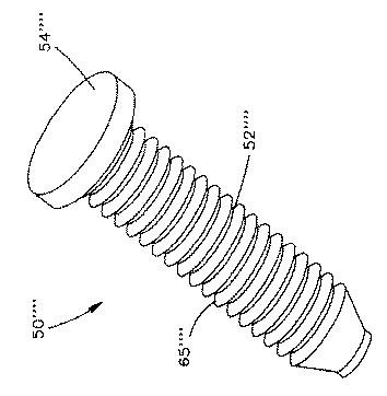 5677850-タックを患者の骨にインパクト駆動で打ち込むための結合体 図000014