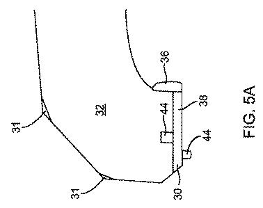 5837876-人工膝患者に深膝屈曲能力を提供するシステム及び方法 図000014