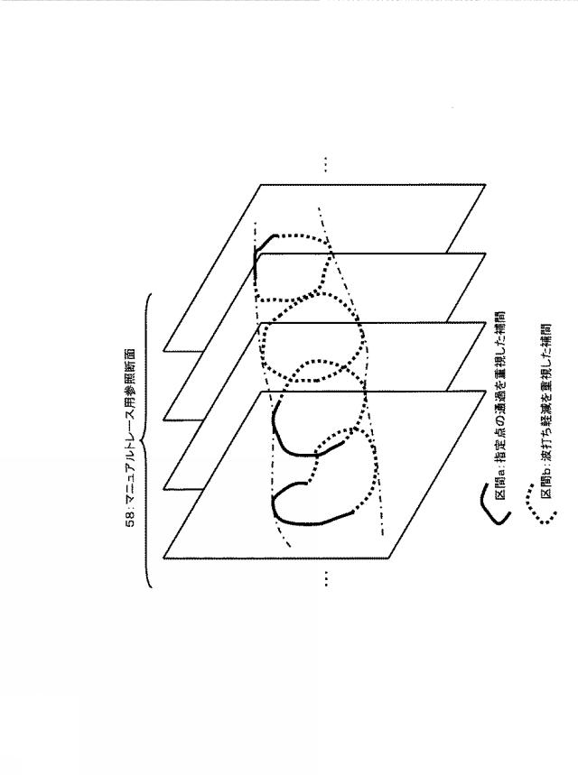 5841771-超音波データ処理装置 図000014