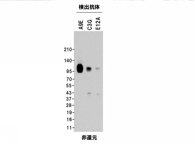 5852433-ソルチリンによる動脈硬化の判定方法 図000014