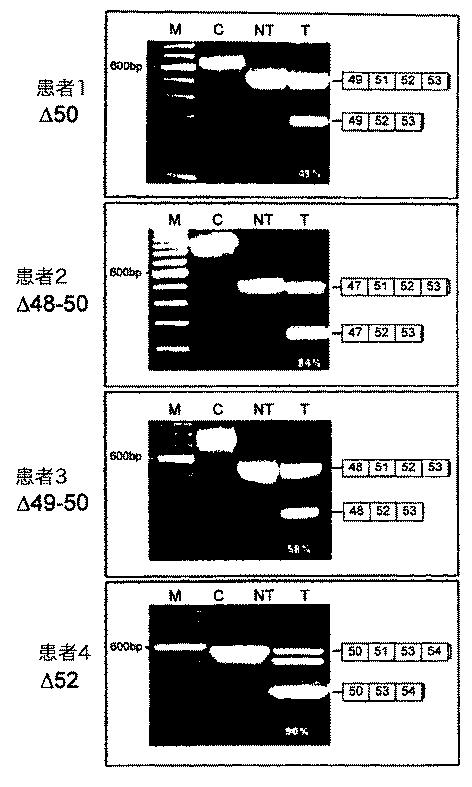 5879374-筋障害を相殺するための手段と方法 図000014