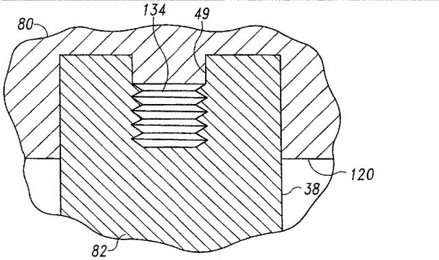 5916989-異なる質感を有する表面を備えた人工関節及びその人工関節の作製方法 図000014