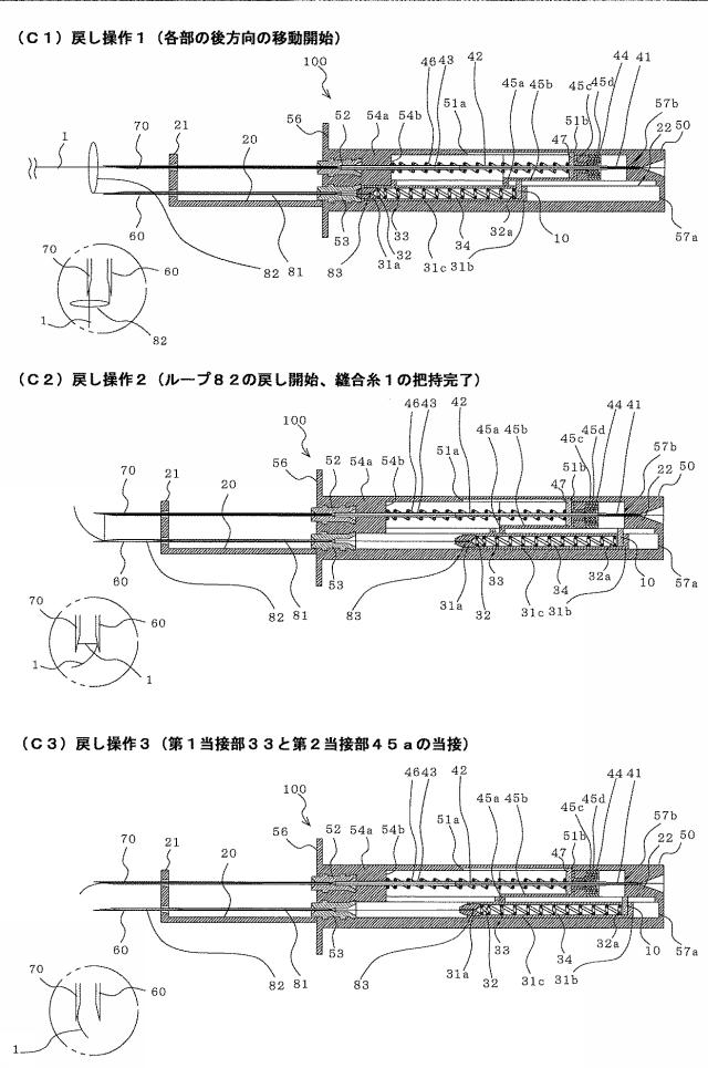 5946335-医療用縫合具 図000014