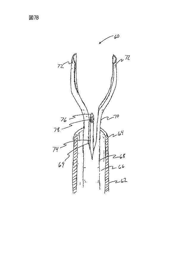 6235672-粘膜下医療処置を実行するための方法及びシステム 図000014