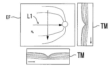 6241040-眼科解析装置、及び眼科解析プログラム 図000014