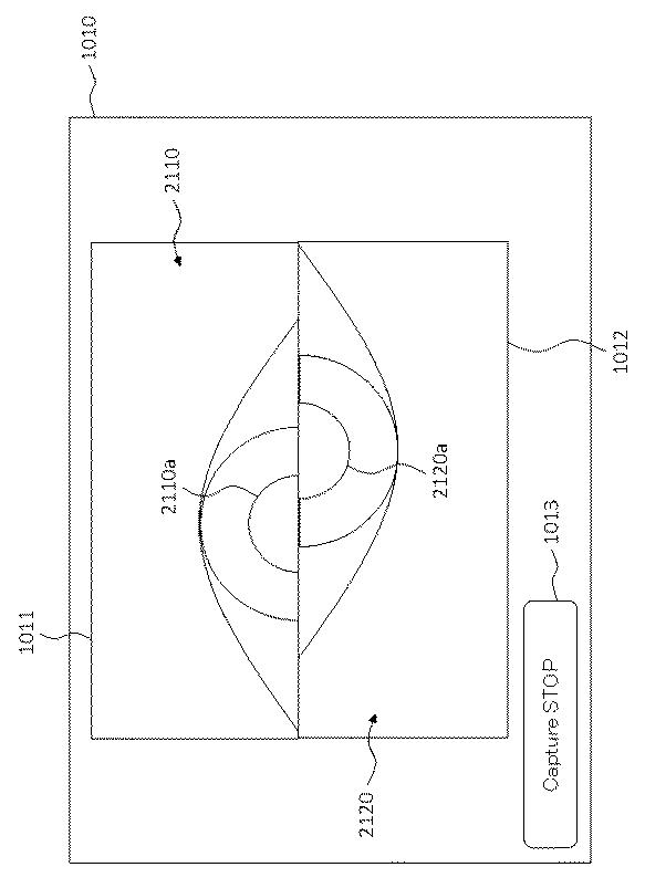 6321430-眼科装置 図000014